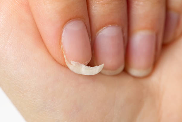7 Simple Steps to Fix a Broken Nail Like a Pro 2 image 27