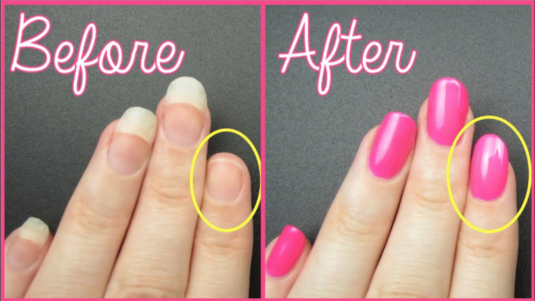 7 Simple Steps to Fix a Broken Nail Like a Pro