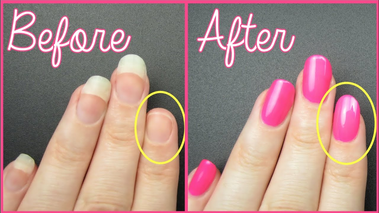 7 Simple Steps to Fix a Broken Nail Like a Pro